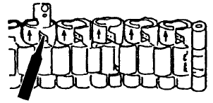 UKLANJANJE KARIKA NARUKVICE