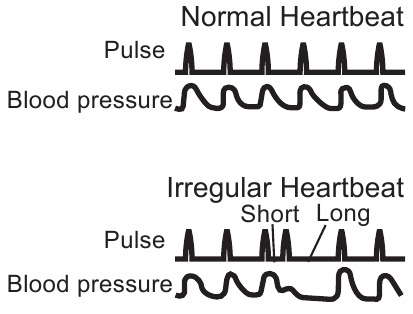 Irregular heartbeat symbol