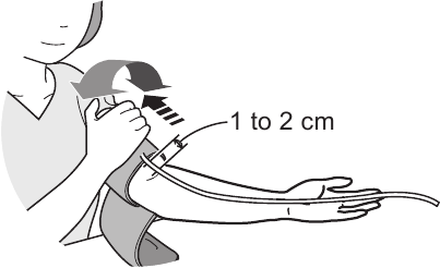 Postavljanje manžete za ruku - Korak 1