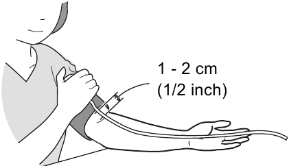 Kuweka Mkono kwenye Kifaa