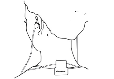 Memakai klip sesuai keinginan Anda